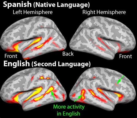 image   brain scan illustrating  difference