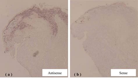 Figure 1 From Expression Profile Of Drosomycin Like Defensin In Oral