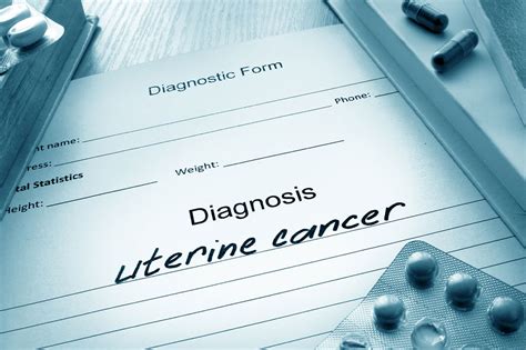 HealthGuide.tips | Uterine cancer – Causes, symptoms, and management