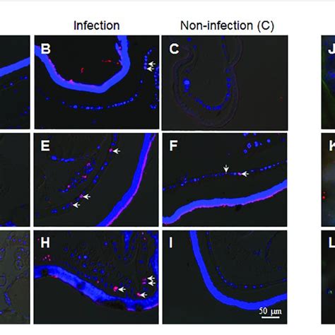 The Fixed Site Infection By B Bassiana Promotes Division In Some Download Scientific Diagram