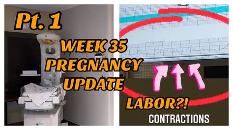 Pt 1 Week 35 Pregnancy Updatewhats In My Hospital Bag Labor Has Started 😳 Youtube