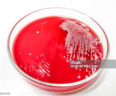 Staphylococcus Aureus Bakteri Gram Positif Nonmotil Hemolisis Beta Pertumbuhan Staphylococcus