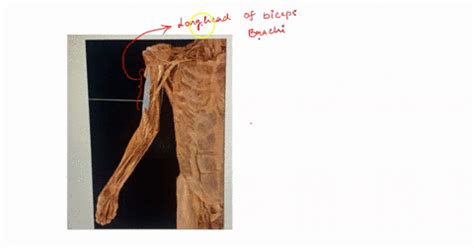 SOLVED Which Muscle Is Attached To The Posterior Layer Of The