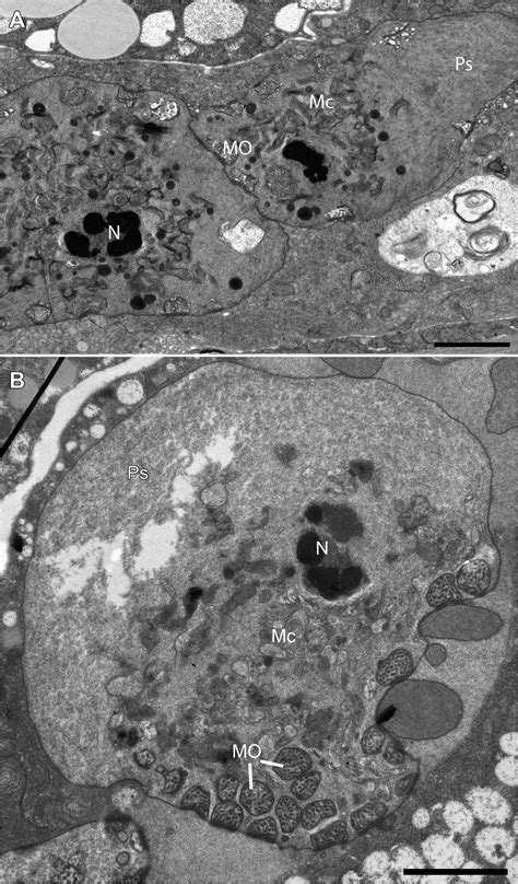 Ditylenchus Dipsaci Mature Sperm Tem A Mature Sperm From Male