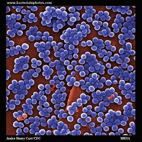 Methicillin Resistant Staphylococcus Aureus Mrsa Under Microscope