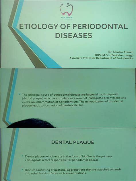 Etiology Of Periodontal Disease Pdf