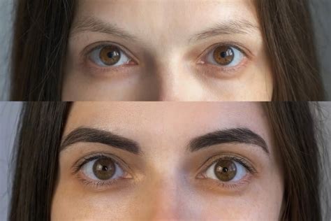 Tout Savoir Du Brow Lift Pour De Beaux Sourcils Le Mag Beaut