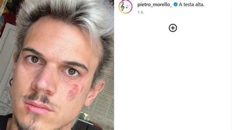 Il Musicista Influencer Torinese Pietro Morello Aggredito Per Strada