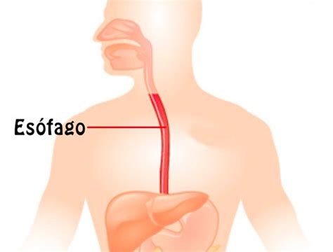 Es Fago De Barrett Endoscopia Para Detectarlo Y M S Cega