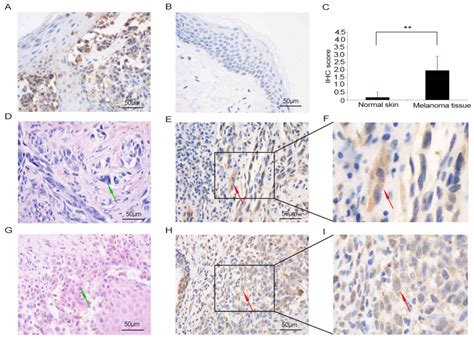 Rnai Mediated Iars2 Knockdown Inhibits Proliferation And Promotes