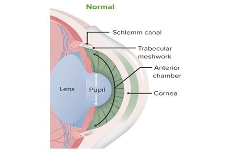 Canal De Schlemm En Ojopedia