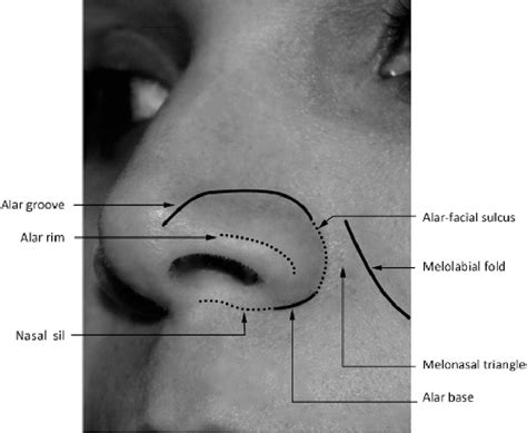 Surface Anatomy Of The Nose For The Dermatologist Semantic Scholar