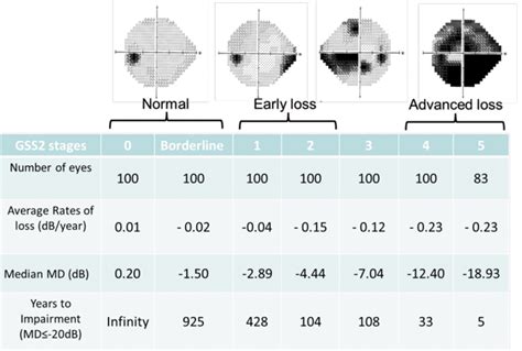 Glaucoma Eye Test Chart