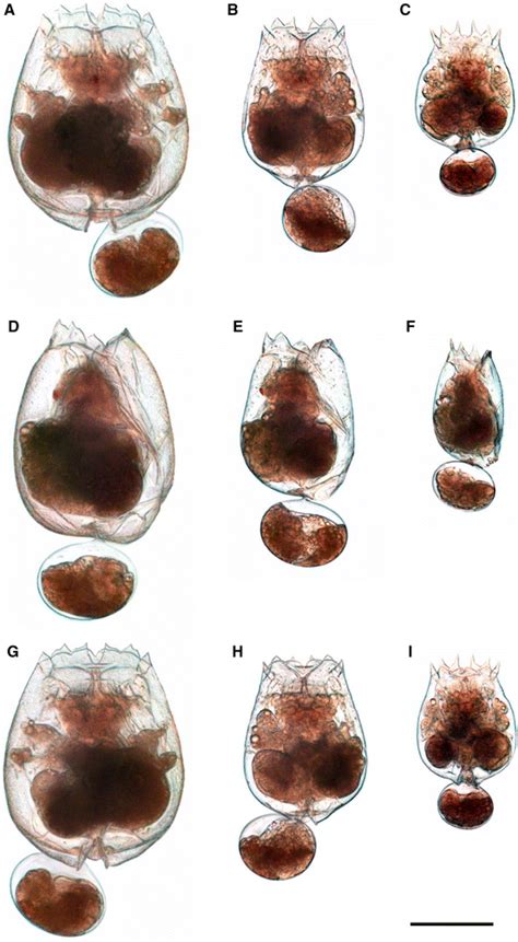 Photomicrographs Of Three Representative Lineages Of The Brachionus