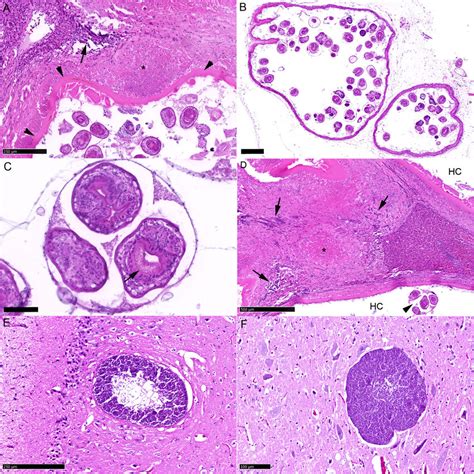 A Liver Part Of Hydatid Cyst With Surrounding Parenchyma Cystic Download Scientific Diagram