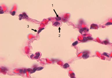 microscope of taste bud Flashcards | Quizlet