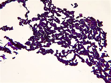 Micrograph Candida Albicans Gram Stain 400x P000022 Oer Commons