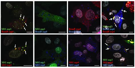 Co Expression Of Ibv Non Structural Proteins Results In Their