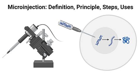 Microinjection: Definition, Principle, Steps, Uses