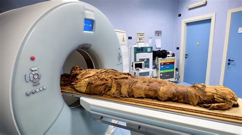 Hospital In Italy Uses Ct Scan To Discover Secrets Of Egyptian Mummy