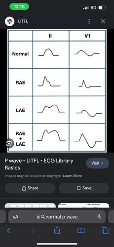 Lead Stuff Flashcards Quizlet