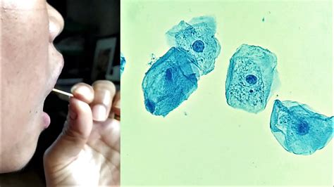 Cheek Epithelial Cell Practical Experiment Youtube