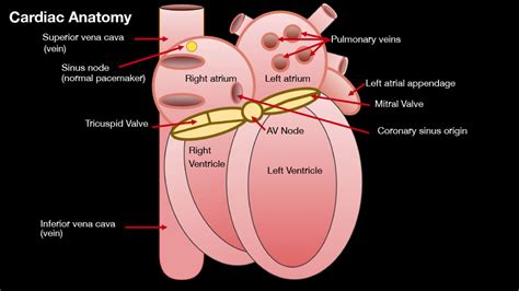 Atrio Ventricular Reentrant Tachycardia Avrt And Wolff Parkinson