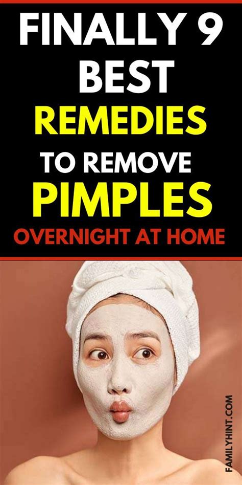 10 Best Home Remedies For Pimples Artofit