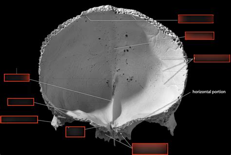 Frontal Bone Posterior Endocranial Diagram Quizlet
