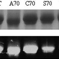 Sds Page Analysis Of Purified Wild Type Wt And Mutant Enzymes The