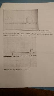 Solved Interpret The H Nmr Spectrum Of Dimedone Estimate Chegg