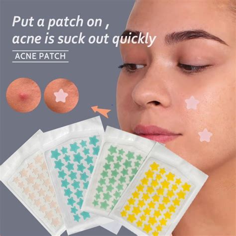 35pcs 40pcs Acne Patch Star Shape Clear Pimple Patch Waterproof Hydrocolloid Acne Cover Sticker