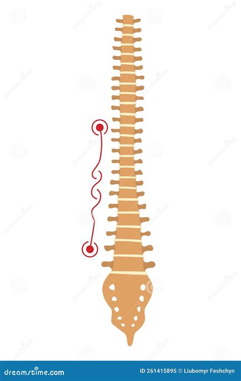 Spinal Deformity Symbol Of Spine Curvatures Or Unhealthy Backbones