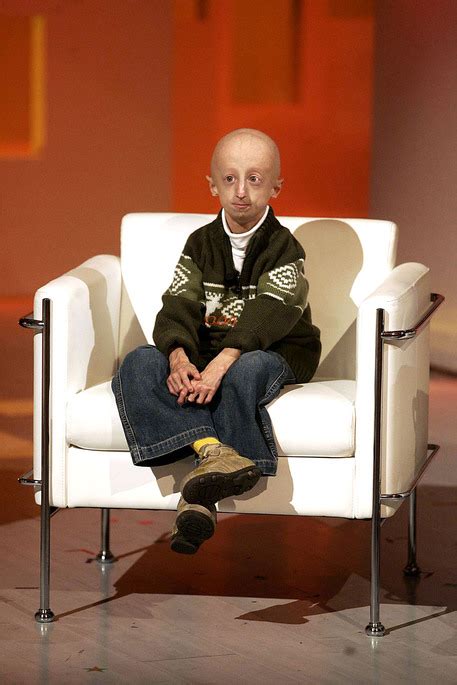 Progeria Sammy Basso Si è Laureato Ultima Ora Ansait