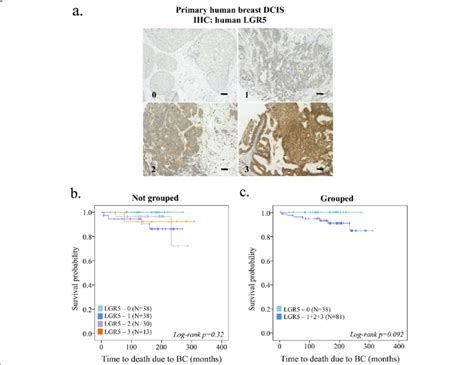 Clinical Importance Of LGR5 In DCIS And Its Prognostic Value A