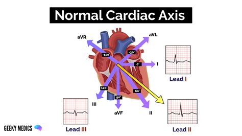 What Is Cardiac Axis ECG Interpretation Geeky Medics