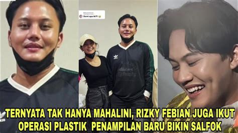 Heboh Ternyata Tak Hanya Mahalini Rizky Febian Juga Ikut Operasi Hidung