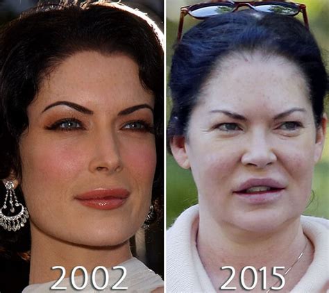 Lara Flynn Boyle Photos Before And After Plastic Surgery Plastic