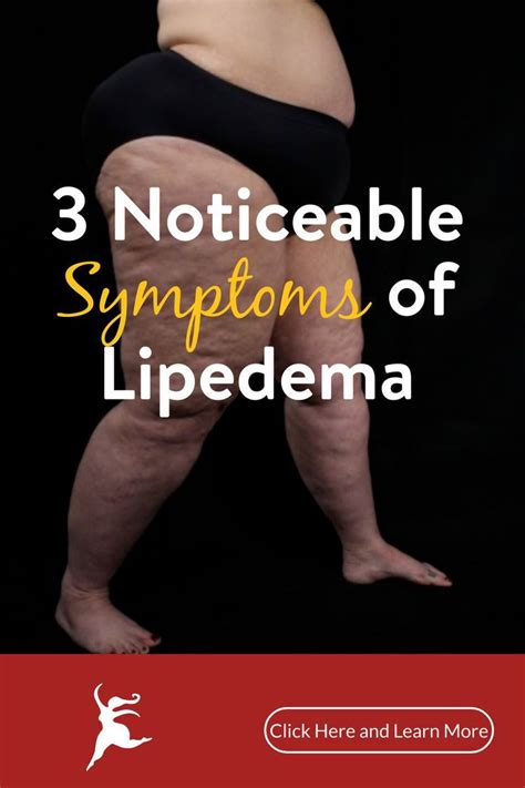 Pin On June Lipedema Awareness Month