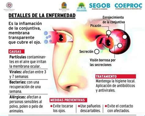 Se Han Detectado 16 Mil Casos De Conjuntivitis En Yucatán