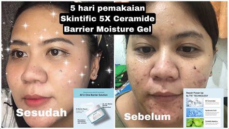 Review Skintific 5x Ceramide Barrier Repair Moisture Gel Pemakaian Selama 5 Hari Youtube