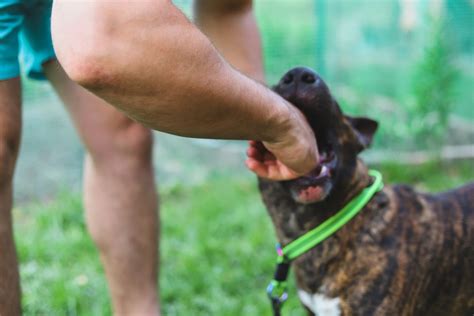 What To Do After A Dog Bite Attack Pushchak Law