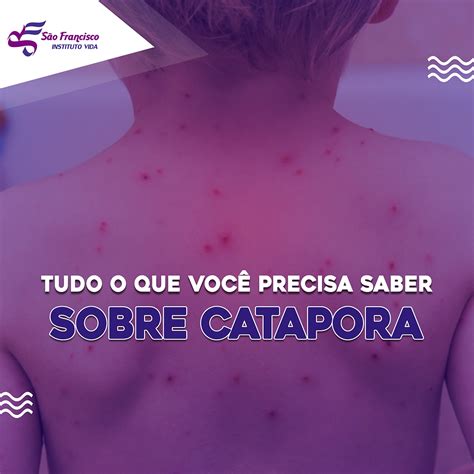 Como Saber Se É Catapora - Como Saber Se é Catapora - NAZAEDU