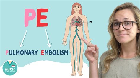 Pulmonary Embolism PE Med Surg Nursing Nursing School Pathology