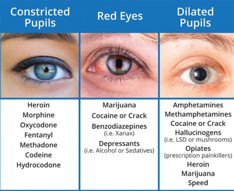 Pin by Dr Tony Lewis on Psychiatry | Medical knowledge, Dilated pupils, Medical facts