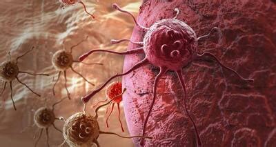 9 blood cancer signs and symptoms you should know | TheHealthSite.com