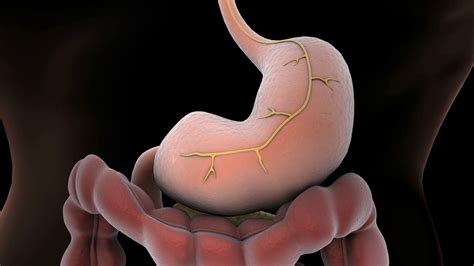 Animation Of Vagotomy Surgical Procedure To Stock Motion Graphics SBV ...