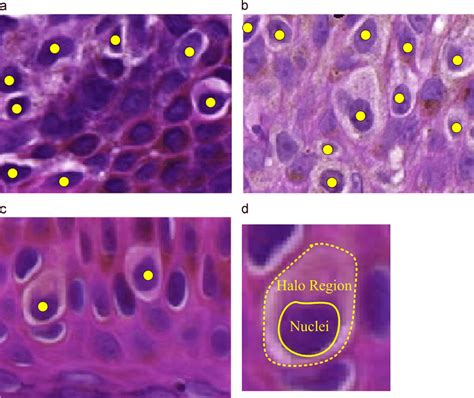 Melanocytes Histology