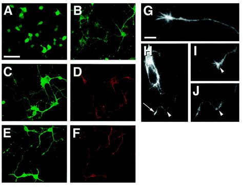 Labeling Neural Cells Using Adenoviral Gene Transfer Of Membrane