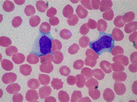 Blood Group Antibodies - Creative Diagnostics